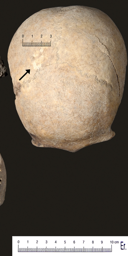 Knochen der Toten von Falein © Archäologischer Dienst Graubünden